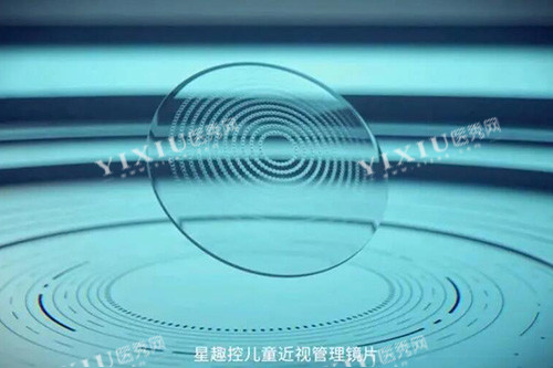 星趣控儿童近视管理镜片