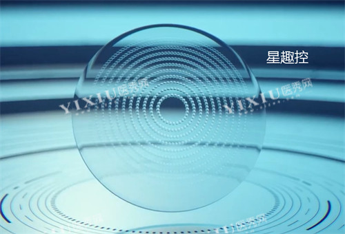 星趣控镜片图