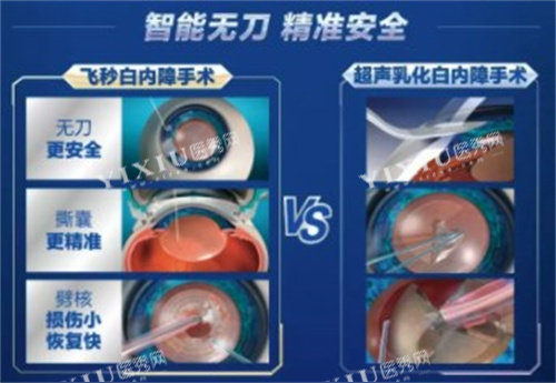 爱尔眼科白内障手术