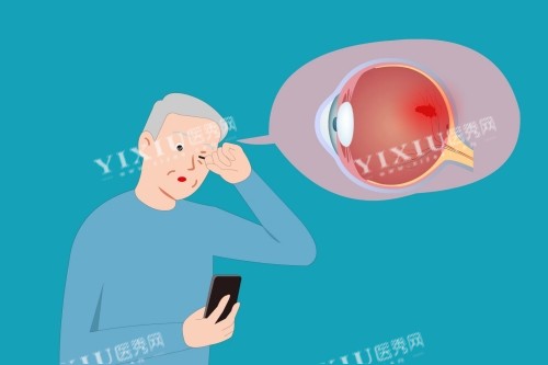 老年人白内障卡通图