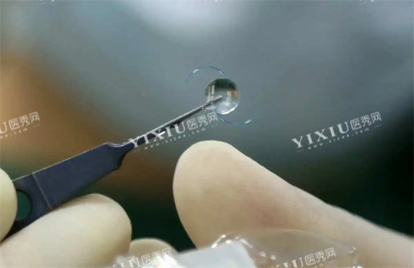 晶体植入特写照片
