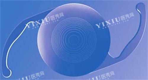 白内障晶体示意图展示