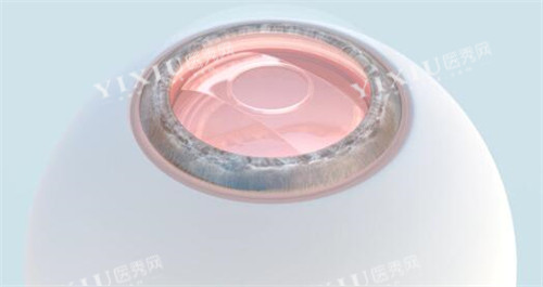 眼球展示图照片