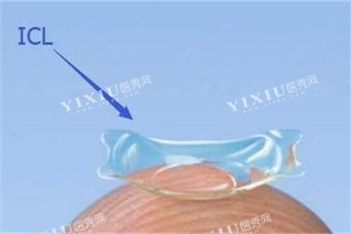 icl人工晶体实物展示图