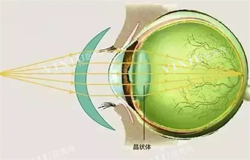 非球面晶体