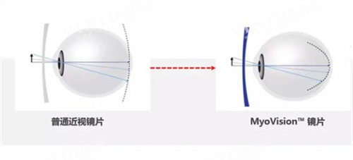 蔡司成长乐镜片原理