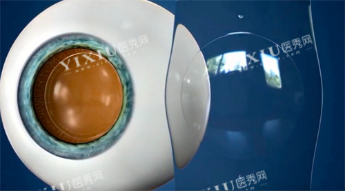 ICL晶体图展示