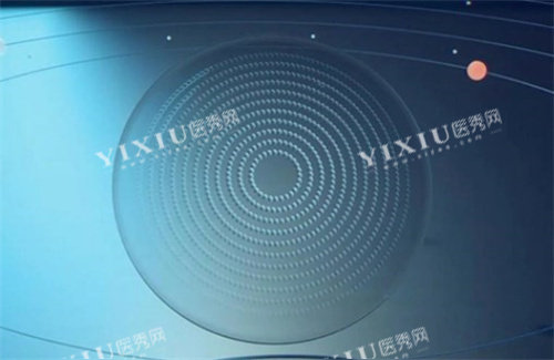 星趣控镜片