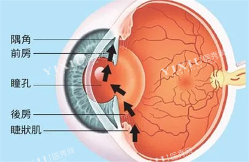 青光眼眼压高的原因