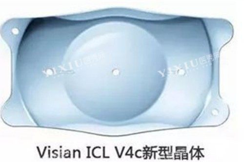 近视眼手术材料