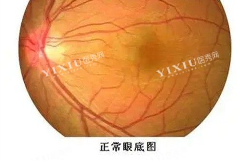 近视眼手术宣传图