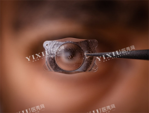 ICL晶体示意图