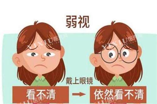 弱视的示意图