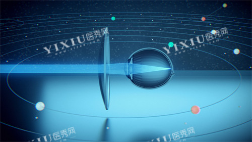 星趣控镜片宣传图