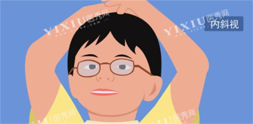 斜视动画图