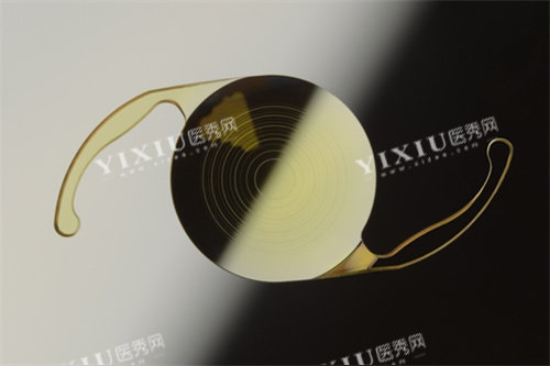 三焦点人工晶体价格