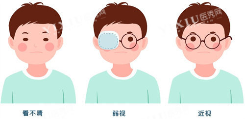 儿童弱视、近视的区别