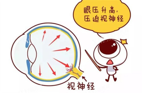 视神经压迫