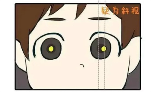 齐首楠和杨隆艳少儿斜视谁看的好?齐首楠医生在常规斜视治疗有优势,而杨隆艳医生在疑难病例处理和综合评估方面更为突出
