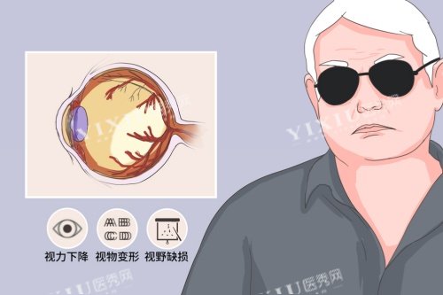视神经萎缩症状图