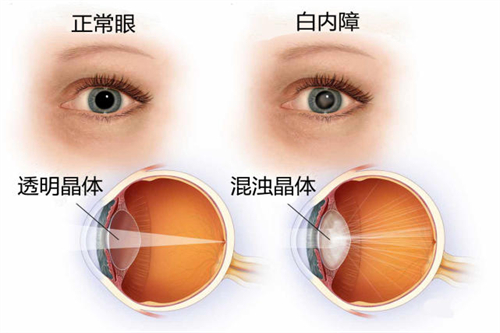 南通大学附属医院眼科电话0513是多少?近视手术询问、预约挂号一站式解答!