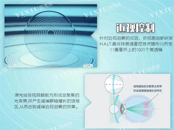近视控制原理图解