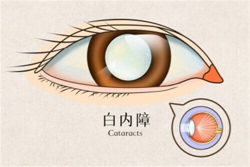 昆明红会眼科医院询问电话是多少？挂号流程、医师坐诊时间、手术费用一键查询！