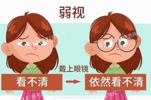 弱视卡通示意图