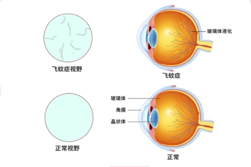 广东医科大学附属医院眼科2026新价目表:近视手术7800元起/白内障4800元起/斜视矫正4000元起,详细费用查询看这里!