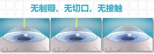 乌鲁木齐空军眼科医院预约挂号攻略!医师号怎么抢?这份指南让你少走弯路!