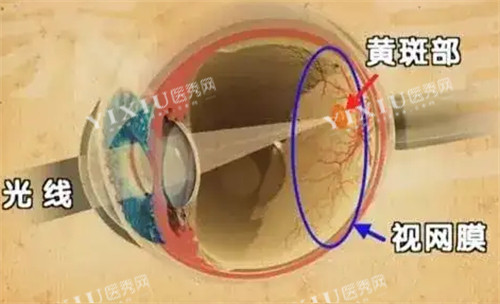 黄斑眼病的发病位置图解