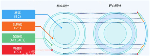 角膜塑形镜不同设计对比