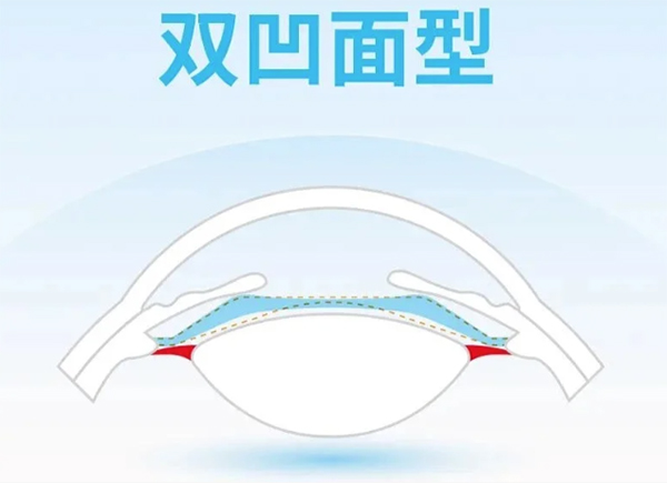 龙晶 PR 晶体靠谱吗?国产创新认证 + 5 万例临床,这 4 点打消顾虑!