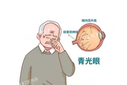 青光眼卡通图