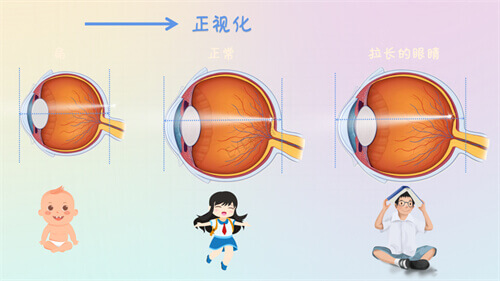 欧普眼视光配镜中心怎么样？儿童配镜体验分享，专科验光师推荐，家长必看！