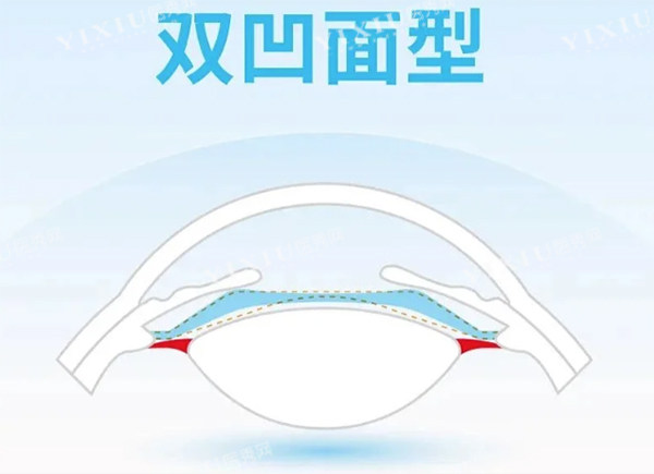 龙晶pr人工晶体双凹面设计