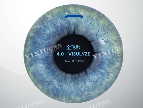 蔡司全飞秒4.0