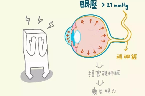 北京青光眼手术价格全解析,2025价格一般3000-8000元起!不同方式价格不等~