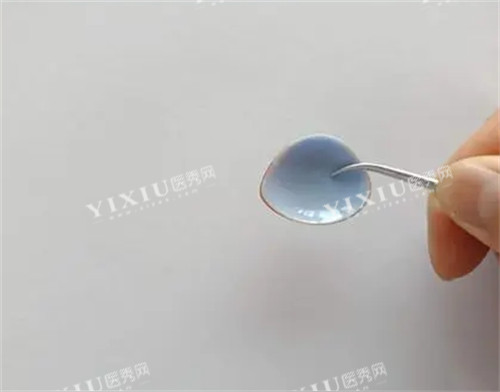 义眼照片