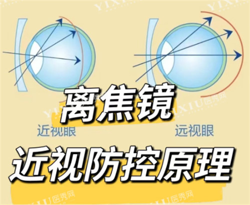 离焦镜片防控原理