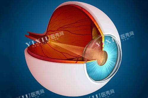 青光眼图片