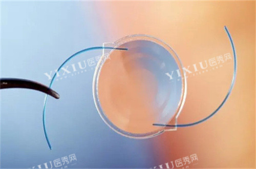 白内障人工晶体