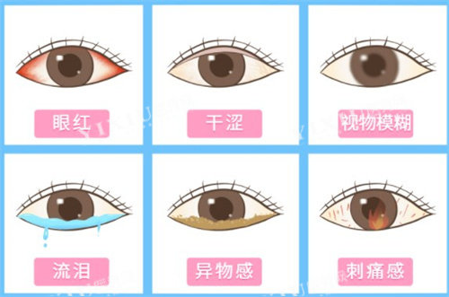 干眼症症状